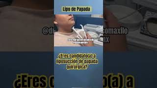 ¿Eres candidato a lipo de papada shorts lipo lipopapada liposuccion liposucciondepapada cmf [upl. by Longfellow]