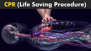 How CPR Procedure Is Performed I CPR Cardiopulmonary Resuscitation [upl. by Rein823]