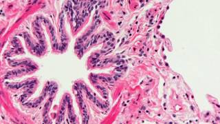 Introduction to Histopathology [upl. by Otrebire252]