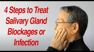 4 Steps to Treat Salivary Gland Swelling at Home [upl. by Ahsinuq]