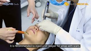 nujuve Combo Skin Booster procedure with aquPEN Auto MTS  2024 Wyne by Dr Kim [upl. by Bj529]