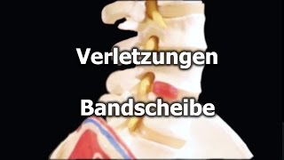 Bandscheibenvorfall  was passiert und was kann ich tun Professor Froböse klärt auf [upl. by Ylrebmi793]