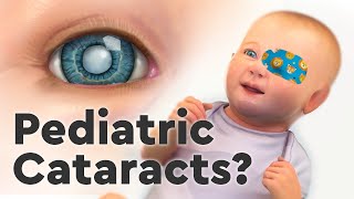 Pediatric Cataracts and the Importance of Care [upl. by Celene335]