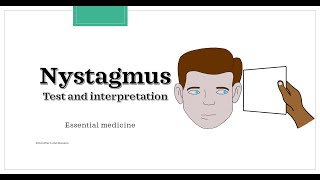 Nystagmus  test and interpretation Essential medicine [upl. by Mcafee]