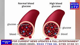 Why does diabetes occur The main reason came out [upl. by Romelle]