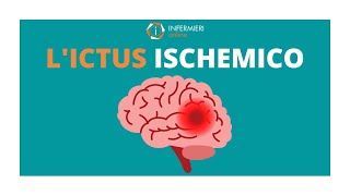 LICTUS ISCHEMICO  STROKE  INFERMIERI Online [upl. by Neneek]