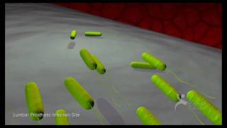 What Are Bacterial Biofilms A Six Minute Montage [upl. by Aicercul181]