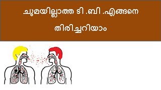 Tuberculous infection Malayalam [upl. by Aiet]