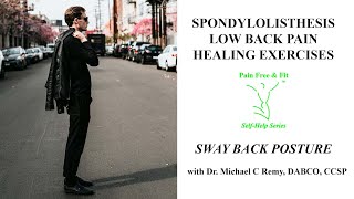 Spondylolisthesis Exercises Sway Back Extension [upl. by Gleeson]