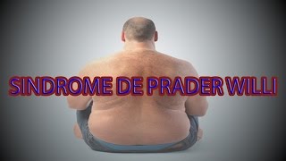 sindrome de prader willis  nacidos con problemas de obesidad [upl. by Gula523]