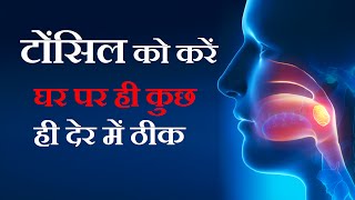 टॉन्सिल्स के घरेलू उपचार Gharelu Upchar for Tonsils in Hindi  Tonsil Home Remedies [upl. by Leavelle]