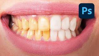 How To EASILY Whiten Teeth In Photoshop [upl. by Ayifa166]