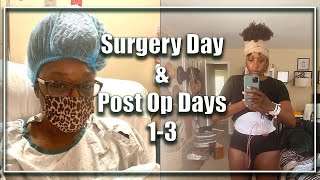 Video Title Extended Tummy Tuck Surgery Day  Post Op Days 13  Muscle Repair amp Lipo [upl. by Falo]