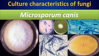 Microsporum canisculture characteristics of fungi [upl. by Idet]