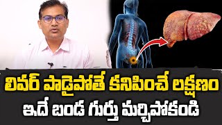 Liver Damage Symptom  లివర్ పాడైపోతే కనిపించే మొదటి లక్షణం  SumanTV Happy Time [upl. by Yaya]