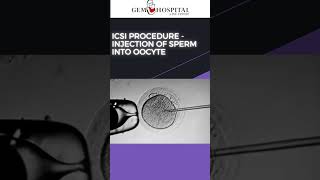 How Does ICSI Work Steps of ICSI procedure  Gem Hospital amp IVF Centre [upl. by Noirod]