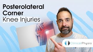 Posterolateral Corner Knee Injuries  Expert Physio Guide [upl. by Aibar508]