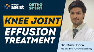 Knee Joint Effusion Kya Hain  What Causes Knee Joint Effusion  Knee Joint Effusion Treatment [upl. by Nepets]