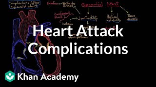 Complications after a heart attack myocardial infarction  NCLEXRN  Khan Academy [upl. by Fey]