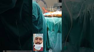 ilizarov type surgery ortho operation with vac dressing [upl. by Sophy]