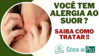 Você Tem Alergia Ao Suor SAIBA COMO TRATAR [upl. by Kalil]