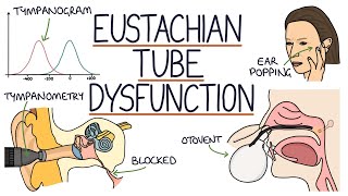 Understanding Eustachian Tube Dysfunction [upl. by Ynohtona]