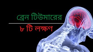 ব্রেন টিউমারের ৮ টি বিপজ্জনক লক্ষণ  8 dangerous signs of brain tumor [upl. by Halimaj292]