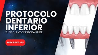 PROTOCOLO DENTÁRIO INFERIOR  TUDO QUE VOCÊ PRECISA SABER [upl. by Lowrance205]