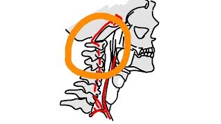 Studie Chiropraktik und Schlaganfälle [upl. by Nuavahs291]