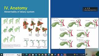 ACUTE CHOLECYSTITIS DR LAY SOURKEIR [upl. by Alyel861]