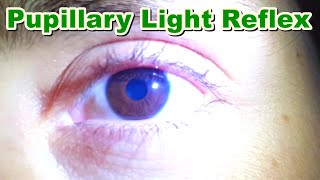 Pupillary Light Reflex  Contraction of Pupil MiosisMyosis  Function  Brain Stem [upl. by Alaecim]