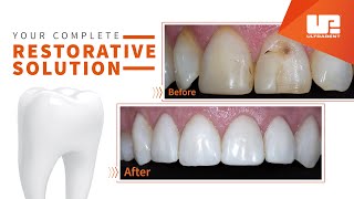 Your Complete Restorative Solution  Ultradent Products [upl. by Oloapnaig]