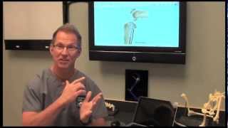 ACL Repair Options amp TPLO discussed by Dr Bauer [upl. by Yssim]