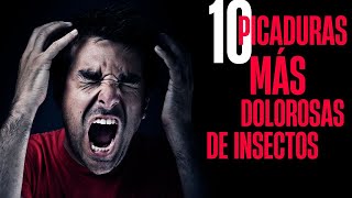 🔥 Las 10 PICADURAS más DOLOROSAS de INSECTOS 🐜 que NO QUERRÁS SUFRIR 😱 [upl. by Rosene251]