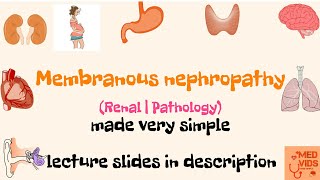 Membranous nephropathy  Renal  Pathology  Med Vids made simple [upl. by Lyndsay]