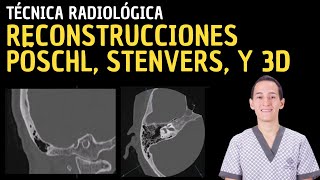 Tutorial Tomografía Computarizada Oído Reconstrucciones Pöschl Stenvers y 3D [upl. by Emrich]