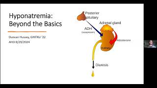 Hyponatremia D Hussey [upl. by Acilegna704]