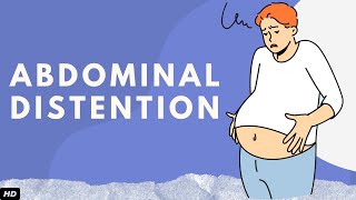 Abdominal Distention Everything You Need To Know [upl. by Euqinue360]