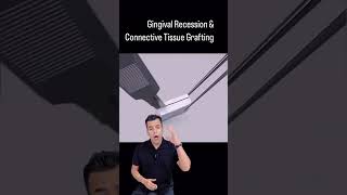 Gum Recession Treatment by Delhi Dentist Reveals Shocking Truth [upl. by Francene]