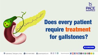 Does every patient require treatment for gallstones  gallstones [upl. by Kramnhoj]