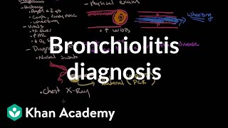 Bronchiolitis diagnosis  Respiratory system diseases  NCLEXRN  Khan Academy [upl. by Aronow]