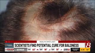 Scientists find potential cure for baldness [upl. by Kiley]