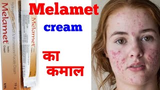 Melamet cream side effects amp Benefits [upl. by Lang]