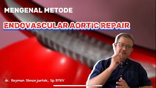 MENGENAL METODE ENDOVASCULAR AORTIC REPAIR DALAM MENANGANI SI PEMBUNUH SENYAP [upl. by Sirrad231]