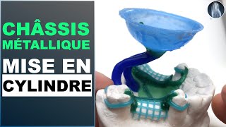 Positionner les tiges de coulée  Guide complet pour la mise en cylindre d’un châssis métallique 🦷✨ [upl. by Nilra]