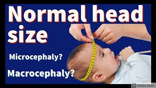 Session 4 Normal head size microcephaly and macrocephaly [upl. by Atineg]