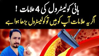 4 Warning Signs of High Cholesterol  Dr Irfan Azeem [upl. by Nnyw]