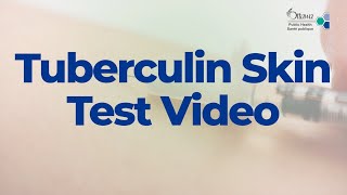 Tuberculin Skin Test Video  2022 [upl. by Idonah716]