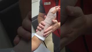 Fiberglass Wrist Splint Volar Splint How to Make [upl. by Cedar]