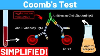 Indirect and direct Antiglobulin test Coombs test  direct and indirect  Panmedicad [upl. by Eeznyl]